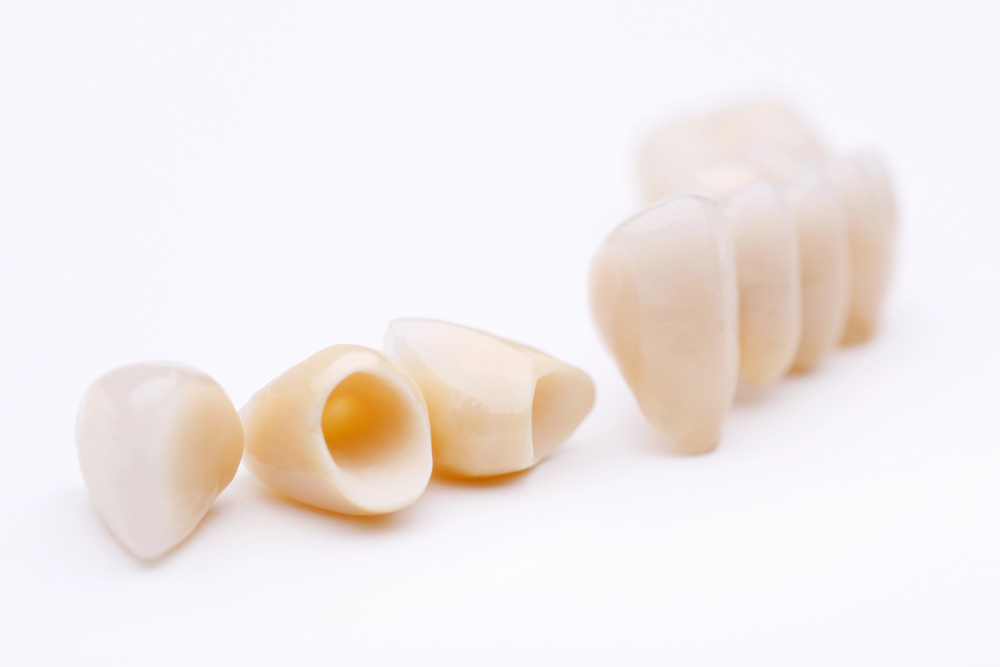 CEREC crowns